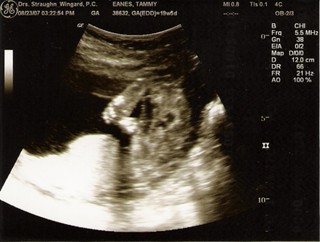 ultrasound pic