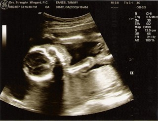 ultrasound pic